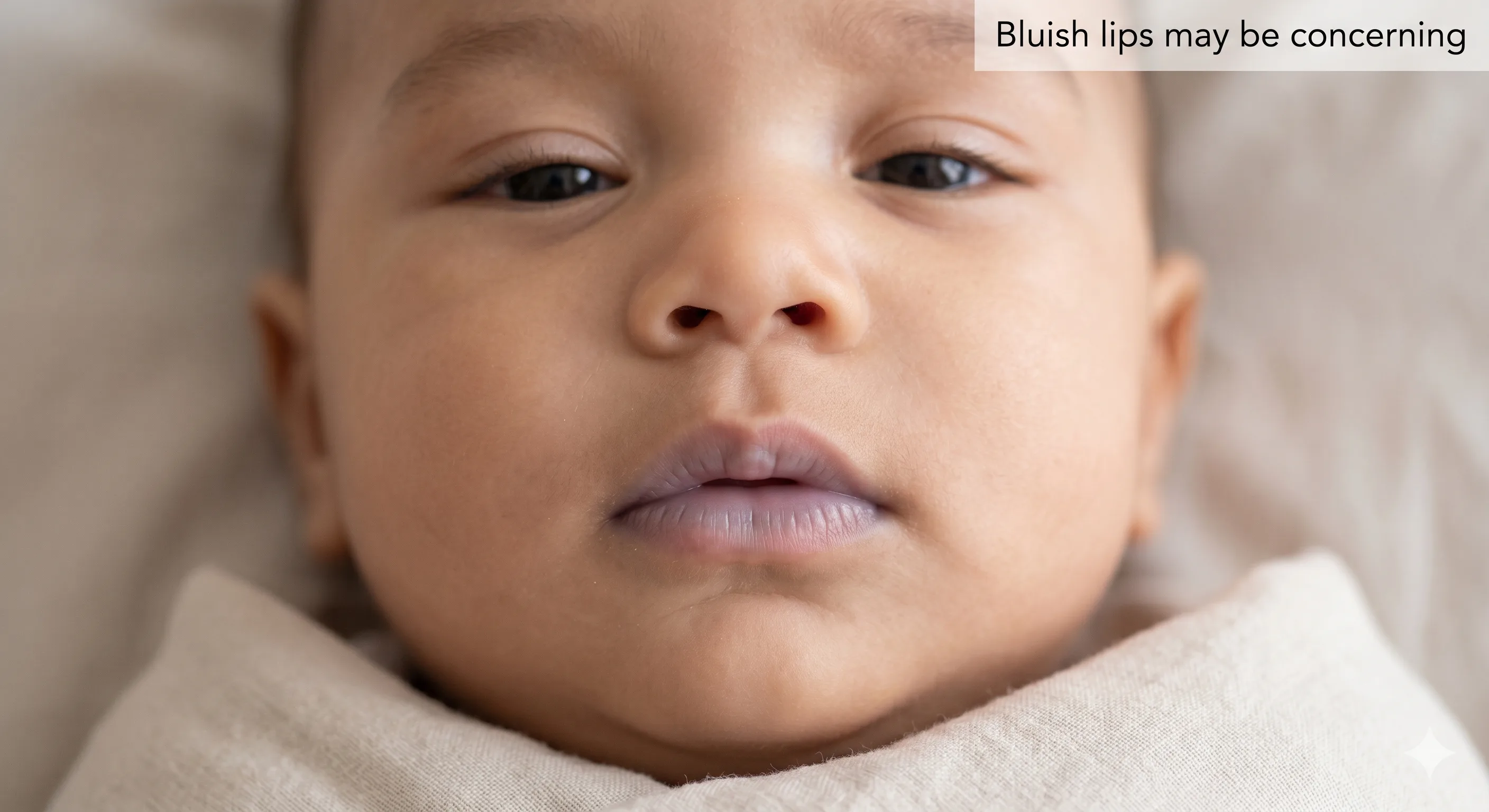 An example of skin color changes showing mottling and poor circulation during a serious illness